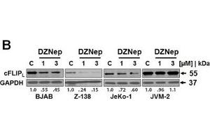 Western Blotting (WB) image for anti-Glyceraldehyde-3-Phosphate Dehydrogenase (GAPDH) antibody (ABIN2857072)