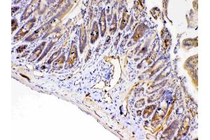 Immunohistochemistry (IHC) image for anti-Peptidylprolyl Isomerase D (PPID) (AA 306-370) antibody (ABIN5693052)