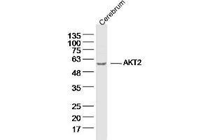 Mouse Cerebrum lysates probed with AKT2 Polyclonal Antibody, unconjugated  at 1:300 overnight at 4°C followed by a conjugated secondary antibody for 60 minutes at 37°C.