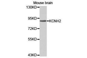 Western Blotting (WB) image for anti-Potassium Voltage-Gated Channel, Subfamily H (Eag-Related), Member 2 (KCNH2) antibody (ABIN1873378) (KCNH2 antibody)