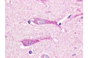 Immunohistochemical staining of Brain (Neurons and Glia) using anti- GPR19 antibody ABIN122129 (GPR19 antibody  (3rd Extracellular Domain))