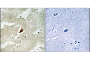 Immunohistochemistry analysis of paraffin-embedded human brain tissue, using MAPKAPK5 Antibody. (MAPKAP Kinase 5 antibody  (AA 171-220))