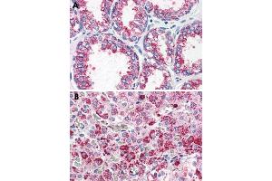 Immunohistochemical staining of formalin-fixed, paraffin-embedded human prostate (A) and human adrenal gland (B) tissue after heat-induced antigen retrieval. (CCKAR antibody  (Internal Region))