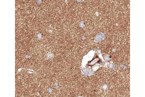 ABIN6266542 at 1/100 staining human brain tissue sections by IHC-P.