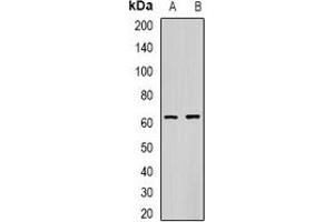 Western blot analysis of CES1 expression in A549 (A), mouse liver (B) whole cell lysates.