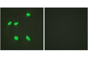 Immunofluorescence analysis of HeLa cells, using Histone H4 (Acetyl-Lys16) Antibody. (Histone H4 antibody  (acLys16))