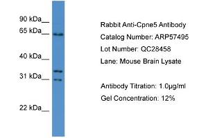 WB Suggested Anti-Cpne5  Antibody Titration: 0. (Copine V antibody  (N-Term))