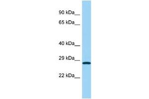 Host: Rabbit Target Name: UCHL1 Sample Type: Fetal Kidney lysates Antibody Dilution: 1. (UCHL1 antibody  (Middle Region))