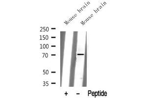 Western blot analysis of extracts of Mouse brain tissue sample,using Kv3. (Kv3.4 antibody  (N-Term))