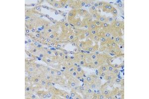 Immunohistochemistry of paraffin-embedded mouse kidney using C antibody (ABIN6129635, ABIN6137807, ABIN6137808 and ABIN6217796) at dilution of 1:100 (40x lens). (CABP7 antibody  (AA 100-180))