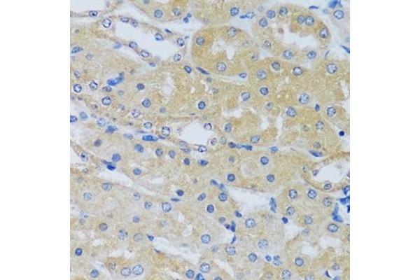 CABP7 antibody  (AA 100-180)