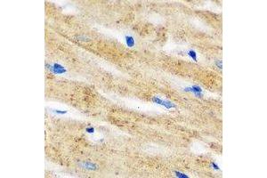 Immunohistochemical analysis of IL-18BP staining in mouse heart formalin fixed paraffin embedded tissue section. (IL18BP antibody)