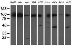 Image no. 2 for anti-Excision Repair Cross-Complementing Rodent Repair Deficiency, Complementation Group 4 (ERCC4) antibody (ABIN1498073) (ERCC4 antibody)