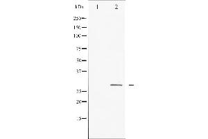 Western blot analysis of HSP27 expression in Ca2+ treated HeLa whole cell lysates,The lane on the left is treated with the antigen-specific peptide. (HSP27 antibody  (Internal Region))