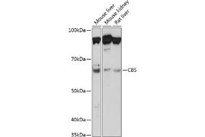 Western blot analysis of extracts of various cell lines, using CBS Rabbit mAb (ABIN7266615) at 1:1000 dilution. (CBS antibody)