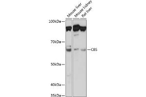 Western blot analysis of extracts of various cell lines, using CBS Rabbit mAb (ABIN7266615) at 1:1000 dilution.