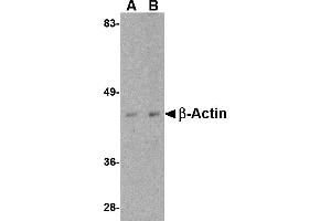 Western blot analysis of actin in HeLa cell lysate with beta-actin antibody at (A) 1 and (B) 2 µg/mL. (beta Actin antibody  (C-Term))