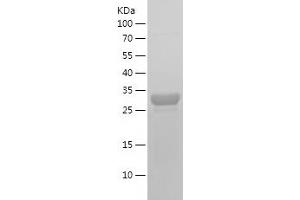 Western Blotting (WB) image for Tumor Necrosis Factor Receptor Superfamily, Member 10a (TNFRSF10A) (AA 379-445) protein (His-IF2DI Tag) (ABIN7125544) (TNFRSF10A Protein (AA 379-445) (His-IF2DI Tag))