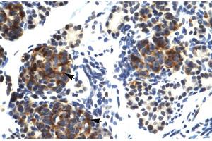 Human Pancreas (TRIM41 antibody  (C-Term))