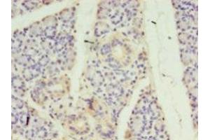 Immunohistochemistry of paraffin-embedded human pancreatic tissue using ABIN7170733 at dilution of 1:100 (STRADB antibody  (AA 212-418))