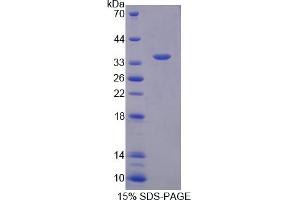 Image no. 1 for Neurochondrin (NCDN) (AA 2-300) protein (His tag) (ABIN4989444)