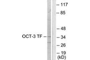 Western blot analysis of extracts from HeLa cells, using OCT3 Antibody. (SLC22A8 antibody  (AA 191-240))
