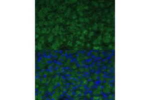 Immunofluorescence analysis of mouse pancreas using CTRB1 Polyclonal Antibody (ABIN7266398) at dilution of 1:100 (40x lens). (CTRB1 antibody  (AA 79-263))