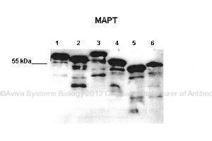 Researcher: Max Holzer, Paul Flechsig Institut of Brain Research, University of Leipzig  Application: Western blotting  Species + Tissue/Cell type:   Lane 1: 10ug E. (MAPT antibody  (Middle Region))