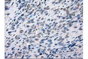 Image no. 4 for anti-Budding Uninhibited By Benzimidazoles 1 Homolog beta (Yeast) (BUB1B) antibody (ABIN1496995) (BUB1B antibody)