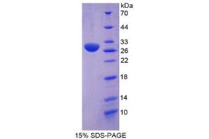SDS-PAGE (SDS) image for POU Domain, Class 2, Transcription Factor 1 (POU2F1) (AA 413-671) protein (His tag) (ABIN2126188)