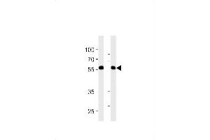 RFTN1 Antibody (Center) (ABIN1881746 and ABIN2843233) western blot analysis in MDA-MB-231,NCI- cell line lysates (35 μg/lane). (RFTN1 antibody  (AA 169-198))