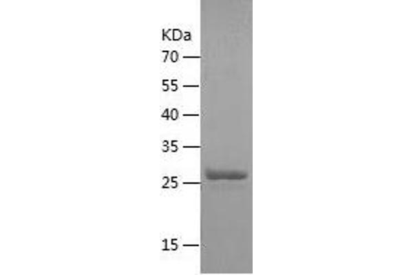 Claudin 3 Protein (CLDN3) (AA 30-80) (His-IF2DI Tag)