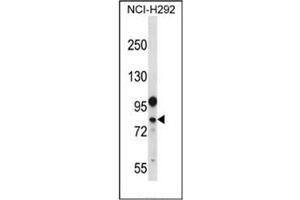 Western blot analysis of DDX3Y Antibody (N-term) in NCI-H292 cell line lysates (35ug/lane). (DDX3Y antibody  (N-Term))