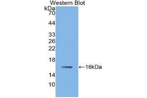 Western blot analysis of the recombinant protein. (NOS1 antibody  (AA 9-136))