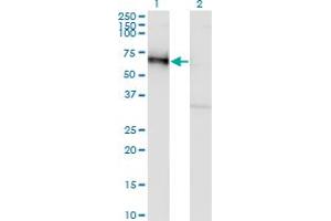 Western Blot analysis of GOLM1 expression in transfected 293T cell line by GOLM1 monoclonal antibody (M06A), clone 5B10. (GOLM1 antibody  (AA 302-401))