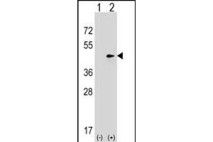 Western blot analysis of SEPT2 (arrow) using rabbit polyclonal SEPT2 Antibody (C-term) (ABIN1537024 and ABIN2848457). (Septin 2 antibody  (C-Term))