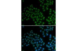 Immunofluorescence analysis of MCF7 cell using SOX2 antibody. (SOX2 antibody  (AA 1-140))
