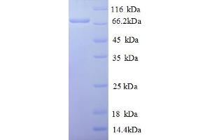c-Rel Protein (AA 3-616, partial) (His tag)