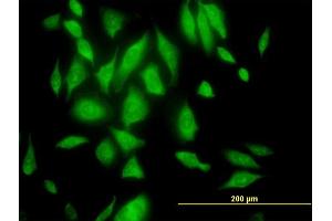 Immunofluorescence of purified MaxPab antibody to RPL29 on HeLa cell.