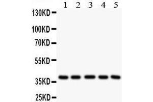 Anti- LOX1 antibody, Western blotting All lanes: Anti LOX1  at 0. (OLR1 antibody  (Middle Region))