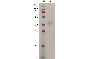 NPC1L1 Protein (AA 22-284) (His tag)