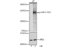 Western blot analysis of extracts of C6 cells, using Phospho-c-Abl-Y412 pAb (ABIN7265966) at 1:1000 dilution or  antibody (ABIN3020871, ABIN3020872, ABIN3020873 and ABIN6213767). (ABL1 antibody  (pTyr412))