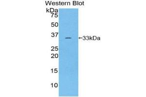 Western Blotting (WB) image for anti-Receptor Tyrosine Kinase-Like Orphan Receptor 1 (ROR1) (AA 540-795) antibody (ABIN1860463) (ROR1 antibody  (AA 540-795))