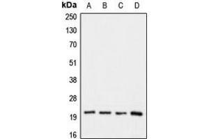 Western blot analysis of Claudin 1 expression in HeLa (A), HepG2 (B), mouse kideney (C), rat kidney (D) whole cell lysates. (Claudin 1 antibody  (C-Term))
