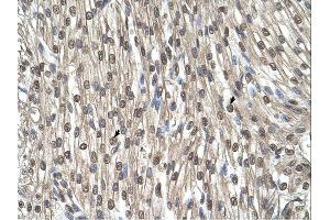 Immunohistochemistry (IHC) image for anti-serine Hydroxymethyltransferase 2 (Mitochondrial) (SHMT2) (C-Term) antibody (ABIN2782503) (SHMT2 antibody  (C-Term))