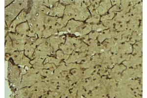 ABIN6276811 at 1/100 staining Mouse brain tissue by IHC-P. (Paired Box 3 antibody  (Internal Region))