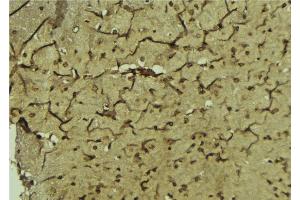 ABIN6276811 at 1/100 staining Mouse brain tissue by IHC-P. (Paired Box 3 antibody  (Internal Region))
