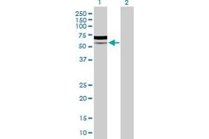 Western Blot analysis of PIK3R5 expression in transfected 293T cell line by PIK3R5 MaxPab polyclonal antibody. (PIK3R5 antibody  (AA 1-494))