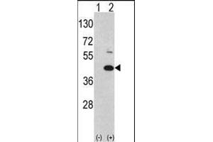 Western blot analysis of MOS (arrow) using rabbit polyclonal hMOS-R8 (ABIN392644 and ABIN2842147). (MOS antibody  (N-Term))