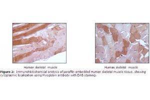 Image no. 1 for anti-Myoglobin (MB) antibody (ABIN207623) (Myoglobin antibody)